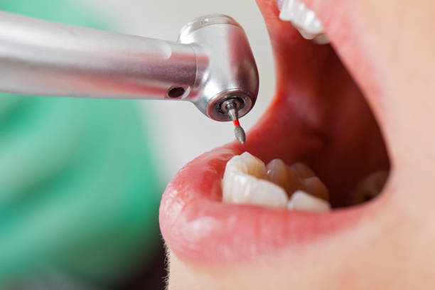 Best Emergency Root Canal Therapy in Palmhurst, TX